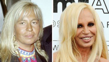 Plásticas – Jocelyn Wilderstein e Donatella Versace – MONDO MODA