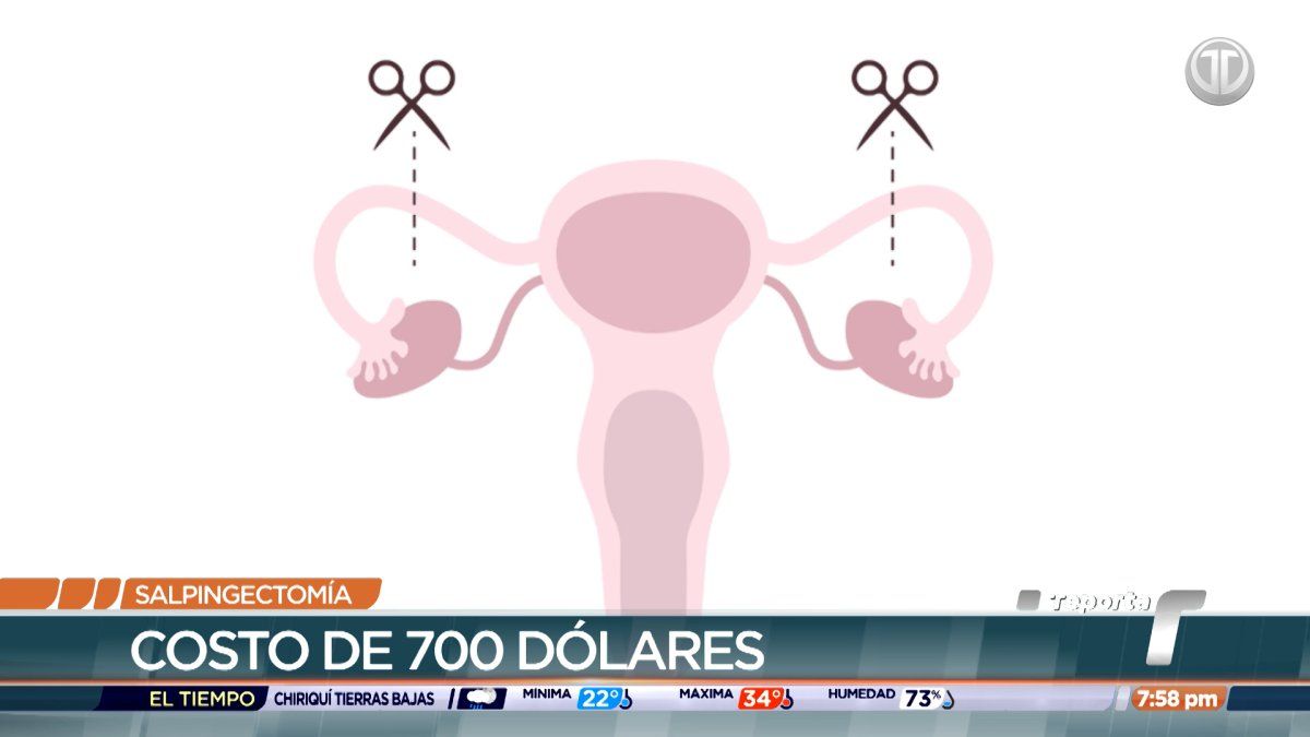Aplafa retoma los servicios de salpingectomía para mujeres desde los 18 años