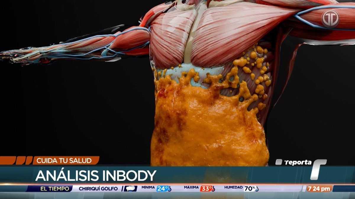 Cuida tu Salud: Análisis InBody