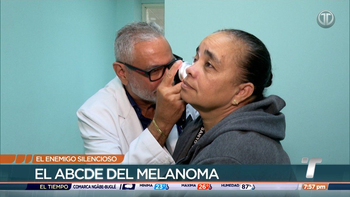 Médicos explican la importancia de revisar los lunares