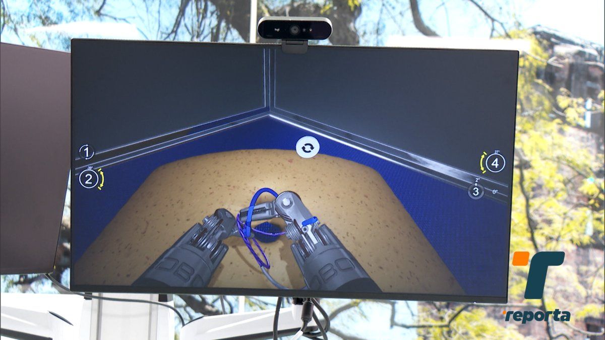 Realizan primera cirugía torácica con asistencia de un robot en la Ciudad de la Salud