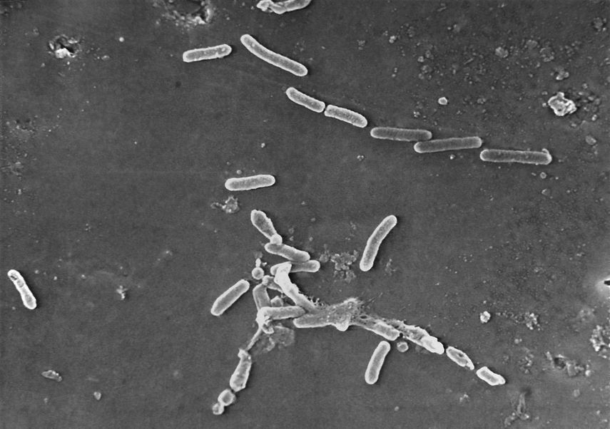 Algunas de las muertes provocadas por las bacterias se relacionan con enfermedades como la tuberculosis.