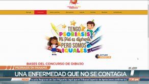 Hay aproximadamente 60