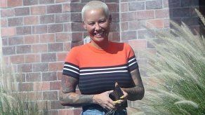 Amber Rose se somete a una liposucción a las seis semanas de dar a luz