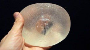 Denuncias sobre implantes PIP se pueden presentar en el MINSA