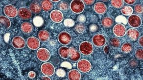 En agosto, la OMS comenzó a consultar a expertos sobre cómo cambiar el nombre de la enfermedad, poco después de que la agencia de la ONU declarara que la propagación de la viruela símica era una emergencia mundial.