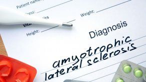 Microbios intestinales pueden influir en desarrollo de esclerosis múltiple