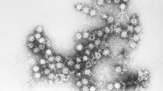 Virus del polio.
