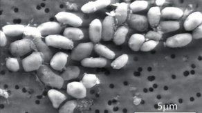 Formación infecciones bacteriales resistentes a antibióticos