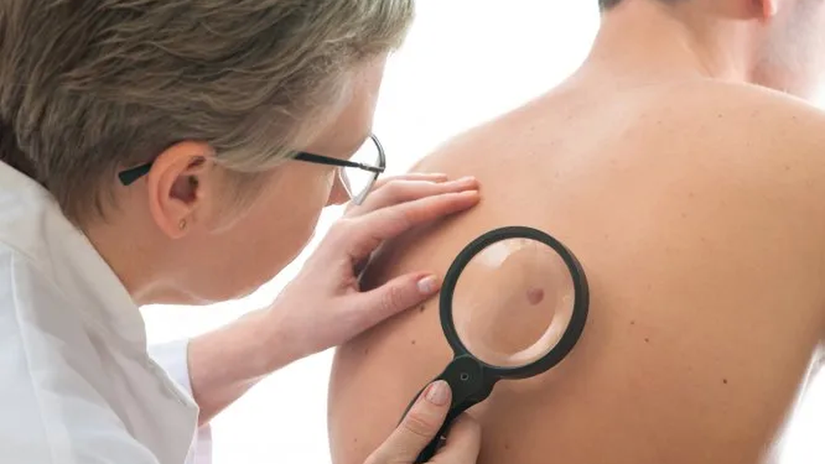 &nbsp;Detección de cáncer de piel.