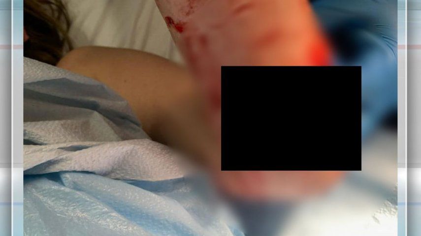 Pez mordió a un jiven en la Playa