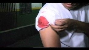 Menores de edad agredieron a periodista para robarle en Milla 8