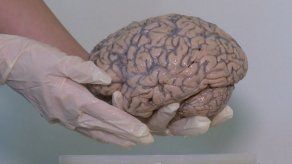 La mayor colección de cerebros del mundo para estudiar las enfermedades mentales