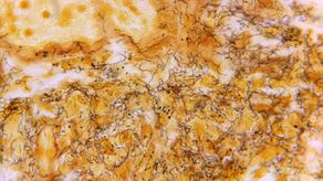 Las tasas de infección de algunas ETS, entre ellas la gonorrea y la sífilis, han estado aumentando por años.