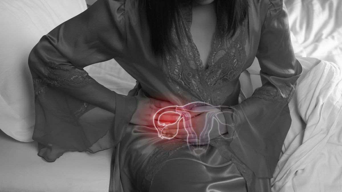 La endometriosis está causada por una migración de las células del endometrio, una mucosa que recubre el interior del útero, al exterior de la cavidad uterina.