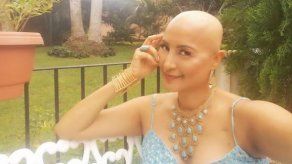 Aquí disfrutando mi calva: Marisela Moreno celebra un año más de vida