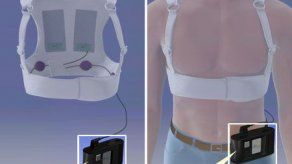 FDA aprueba dispositivo cardiaco externo para uso en niños