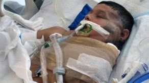 Sale de atención intensiva niño mexicano con tumor