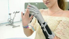 Prótesis impresas en 3D cambian vida de personas de bajos recursos en México