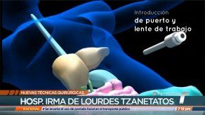 Implementarán nuevas técnicas quirúrgicas en el Hospital Irma De Lourdes Tzanetatos