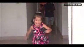 Hannah Yanneth primera siamesa operada en Panamá llegó a 3 años