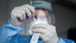 La tasa de letalidad del COVID-19 en Panamá se mantiene en 1.7%.