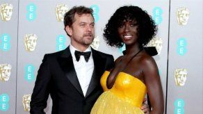 Jodie Turner-Smith usa la leche materna para tratar el acné posparto