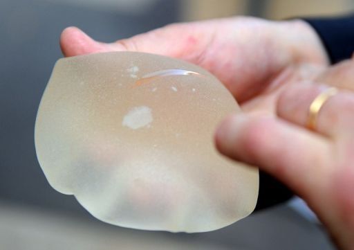Veredicto del proceso de implantes PIP se pronunciará el 10 de diciembre