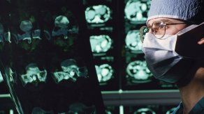 Científicos mexicanos desarrollan método de biopsia cerebral menos invasivo