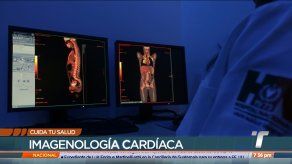 Cuida tu salud: Imagenología cardíaca