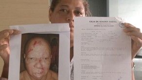 Denuncian supuesta agresión policial contra un joven Denuncian supuesta agresión policial contra un joven