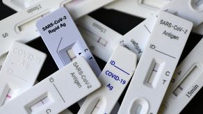 Prueba rápida para detectar covid-19.