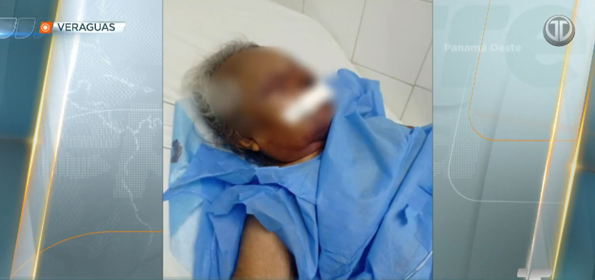La adulta mayor fue trasladada&nbsp; al Hospital Santo Tomás en Panamá.