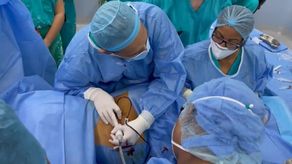 La transfusión fetal intrauterinatrata es un proceso novedoso en el sistema público de salud con especialistas panameño, según la CSS.