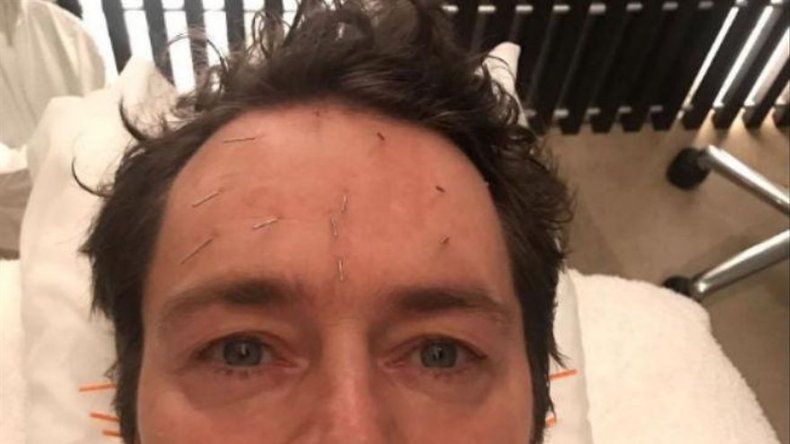 Howard Donald recurre a la acupuntura facial para dejar de comer compulsivamente