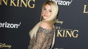 Meghan Trainor ha machacado su ansiedad