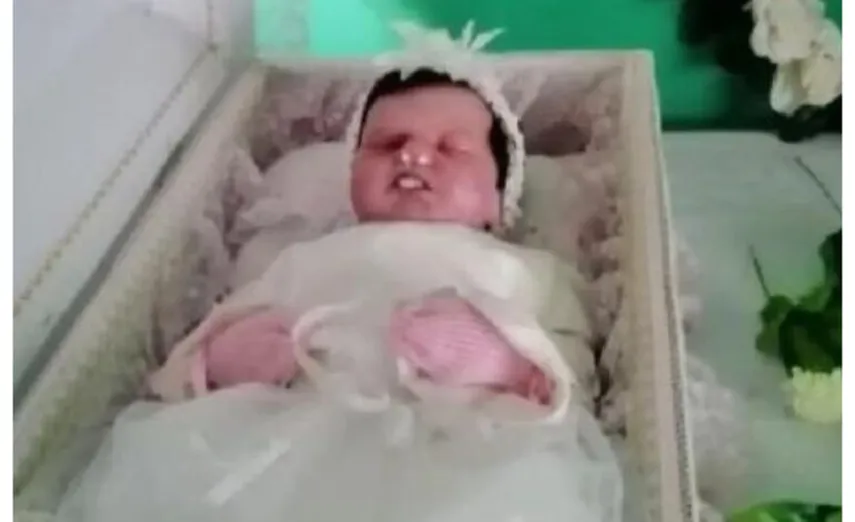 Muñeca intercambiada con el cuerpo de una bebé.