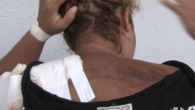 Mujer sobrevive a machetazos en Chiriquí