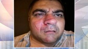 Abogado Trelles presentará reclamos tras sufrir daños por bomba lacrimógena Abogado Trelles presentará reclamos tras sufrir daños por bomba lacrimógena