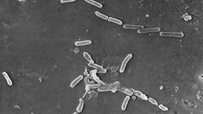 Algunas de las muertes provocadas por las bacterias se relacionan con enfermedades como la tuberculosis.