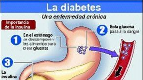 La diabetes incrementa el riesgo de Alzheimer en hombres