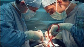 Conectan el primer corazón artificial externo a una mujer