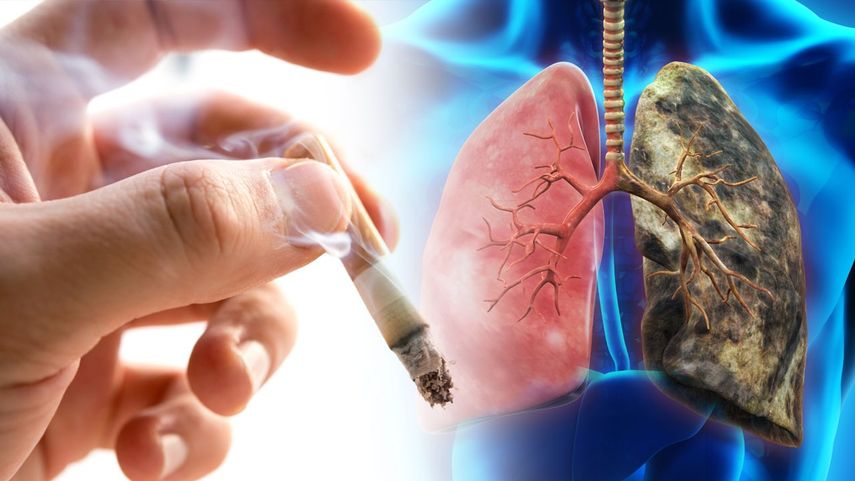 Panamá fortalecerá estrategias para disminuir muertes por tabaco en el mundo