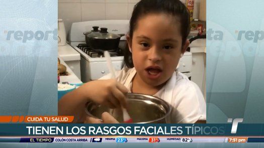 Cuida tu Salud: Síndrome de Down