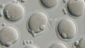 Equipo japonés se postula para 1er ensayo clínico con células iPS