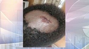 Joven denuncia que fue agredido por policías en Veraguas Joven denuncia que fue agredido por policías en Veraguas