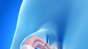 El blanqueamiento del pene que proponen en Tailandia preocupa a los cirujanos