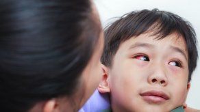 Minsa reporta 36 casos de conjuntivitis en la provincia de Colón