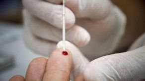 Los científicos descubren cómo el VIH infecta las células