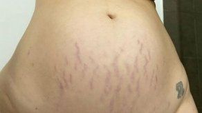 Ashley Graham normaliza las estrías tras el embarazo